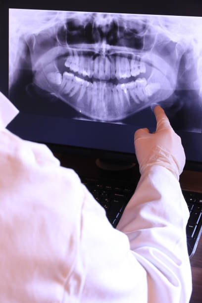 Best Weekend Emergency Dentist in Beesleys Point, NJ