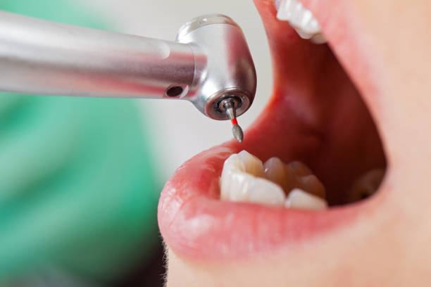 Best Pediatric Emergency Dentist in Beesleys Point, NJ